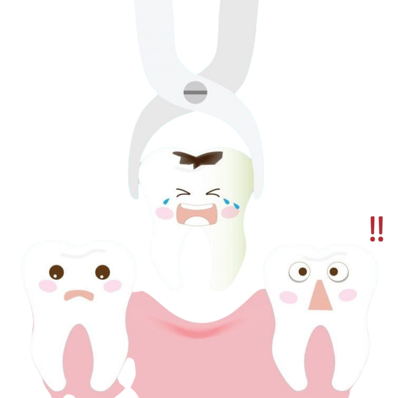 Extraction